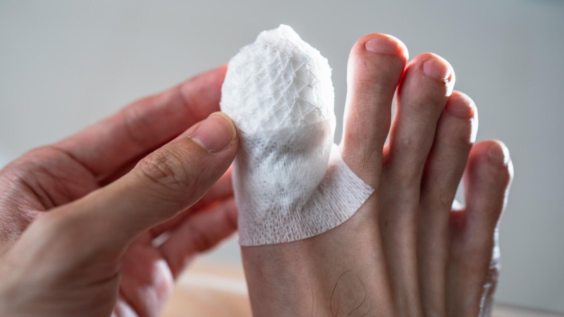 Ушиб или перелом: как распознать и лечить травму пальца ноги